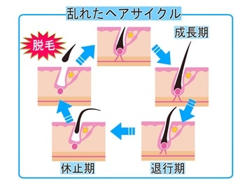 チャップアップ 効果 期間